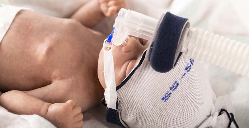 neonatal resuscitation