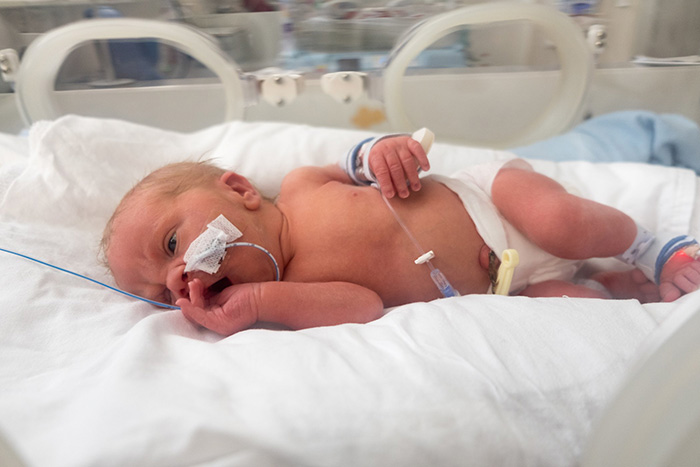 NICU Birth Injury