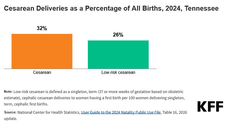 c-section deliveries in Tennessee