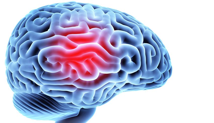 newborn seizure disorders