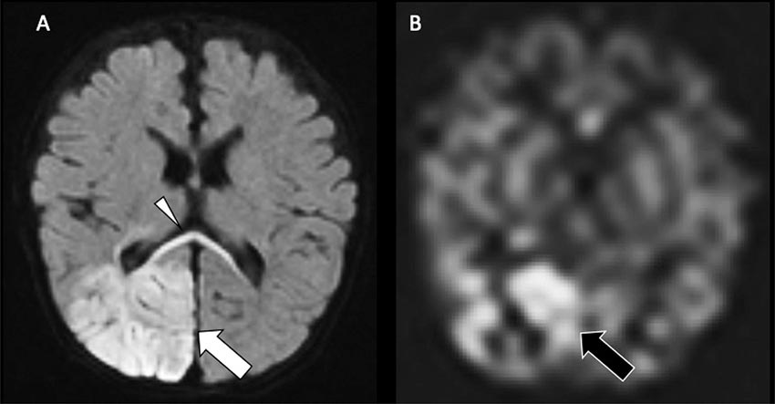neuroimaging tests