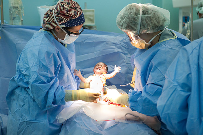 C-section