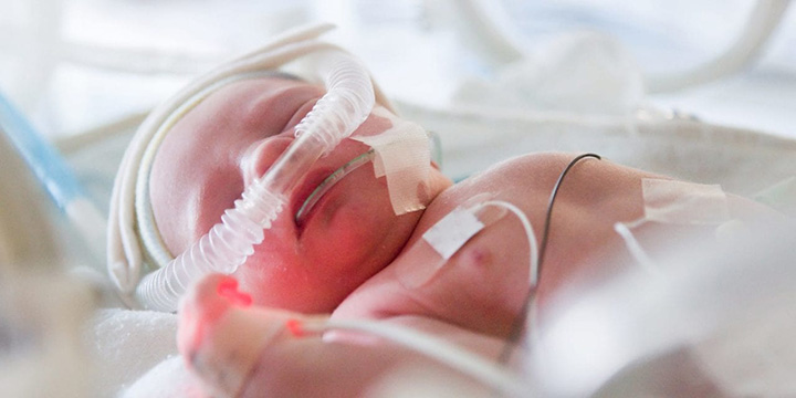 newborn over-ventilation risks